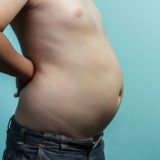 Gonfiore e meteorismo intestinale: cosa fare